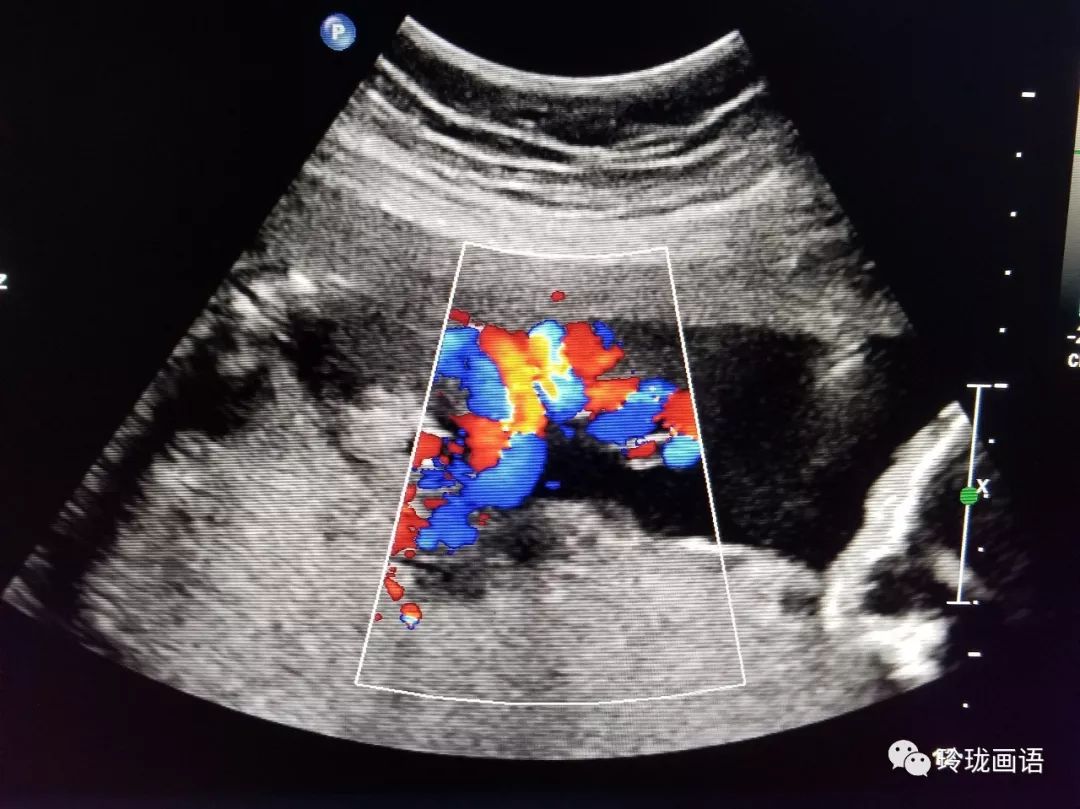 产检B超，那些数字到底什么意思_周玲_副主任医师_爱问健康
