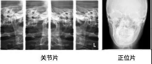 你还看不懂X光片?徐医生带你全面解析_徐巍娜_主任医师_爱问健康