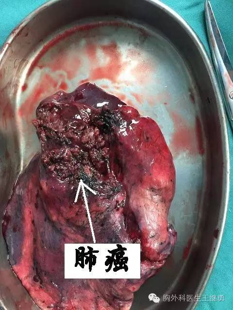 宁波第一医院胸外科：守护健康背后的故事