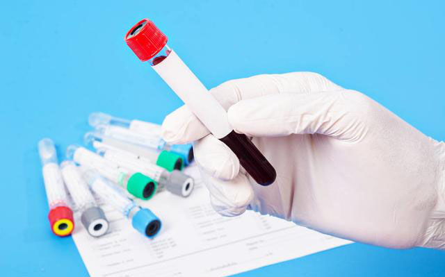 电解质用什么管子抽血辟谣：医院抽了好几次血，都抽成贫血了？医生：抽血很必要！_https://www.jmylbn.com_新闻资讯_第5张