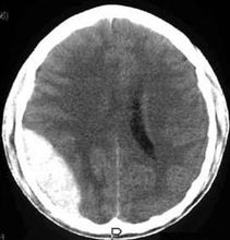 孩子摔跤后昏迷不醒妈妈这样做救了一命