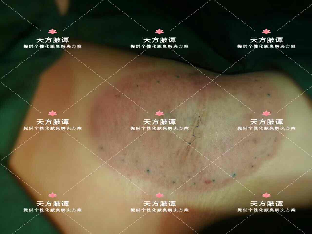 【一千零一腋】之880_陈斌_主治医师_爱问健康