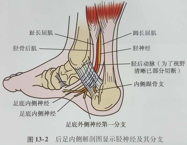 有统计数据表示 大概有20%的跟骨前方疼痛是由于足底外侧神经第一分支