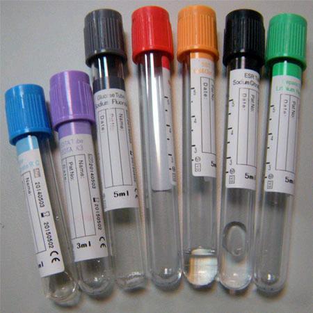 采血用什么管抽血用五颜六色的管子，原来是起这个作用的！_https://www.jmylbn.com_新闻资讯_第1张