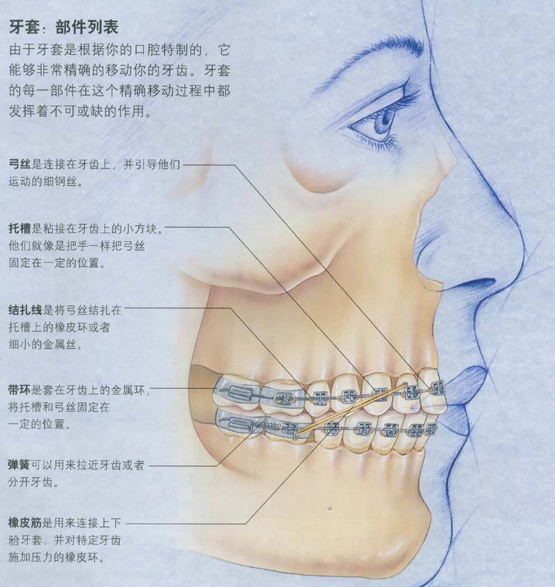 图解 带你正确认识牙齿矫正的科学原理