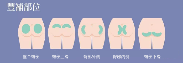 天天夹紧臀部就能练成性感蜜桃臀?其实做这个就行了!