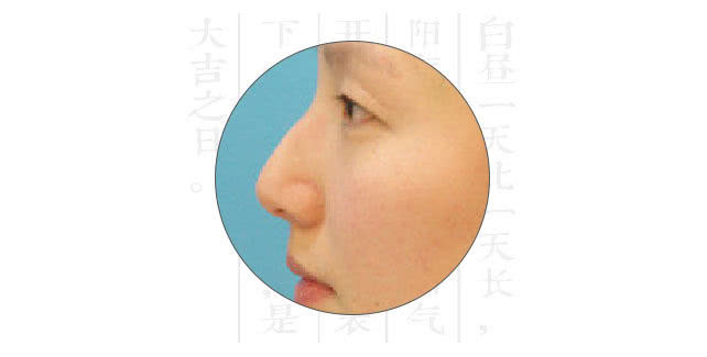 国人最常见6中鼻型大全，对应鼻整形解决方法_吴胜_主治医师_爱问健康