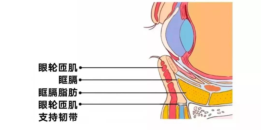 眼睛下方的那三团眶隔脂肪,表面除了有皮肤,肌肉外,还有很多对脂肪有"