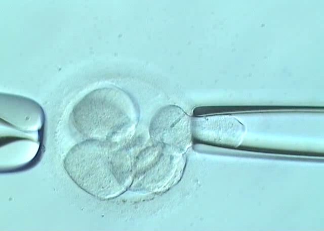 語学・辞書・学習参考書 Preimplantation Genetic Diagnosis Overview and Historical Perspective of Preimplantation