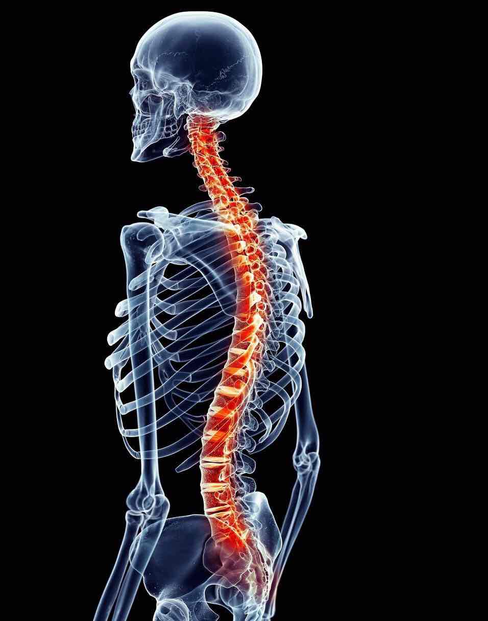 脊椎问题的相关性与功能障碍