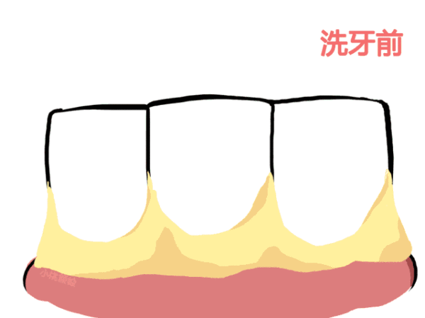 v2-5be68cfea741ec9d24be6f16b732e866_b.gif