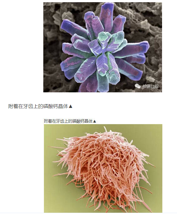 细菌图片显微镜牙齿
