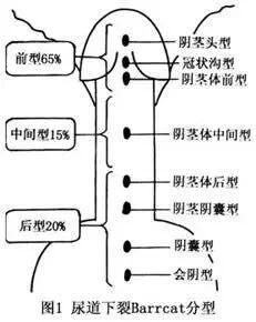 男性系带过短图片