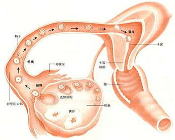 正确认识巧克力囊肿