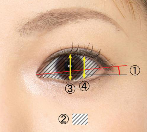 ④为下至术下眼睑下拉的方向,在此方向下拉,使眼睛变大,下眼睑呈优美