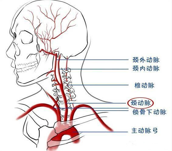 颈动脉体瘤位置图片图片