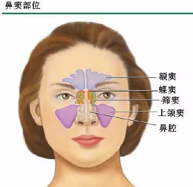 季节多见,其发生的部位与鼻窦的发育先后有关,上颌窦和筛窦较早发育