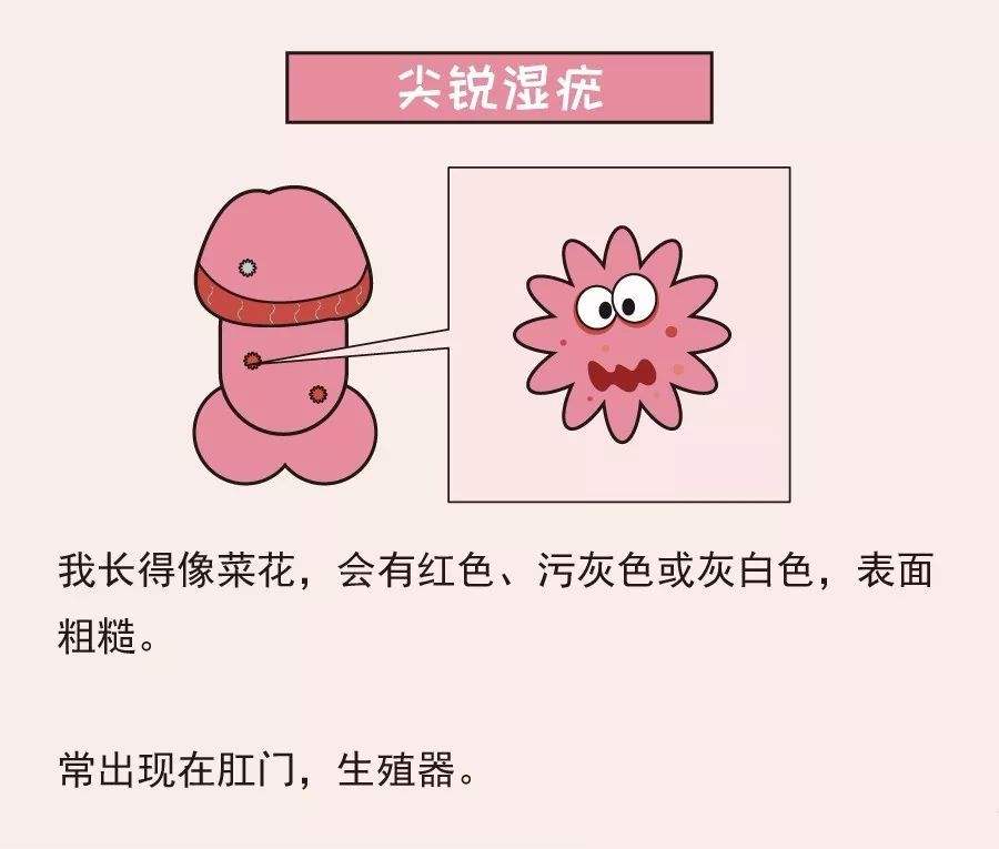 尖锐湿疣系带旁腺丘疹别傻傻的分不清