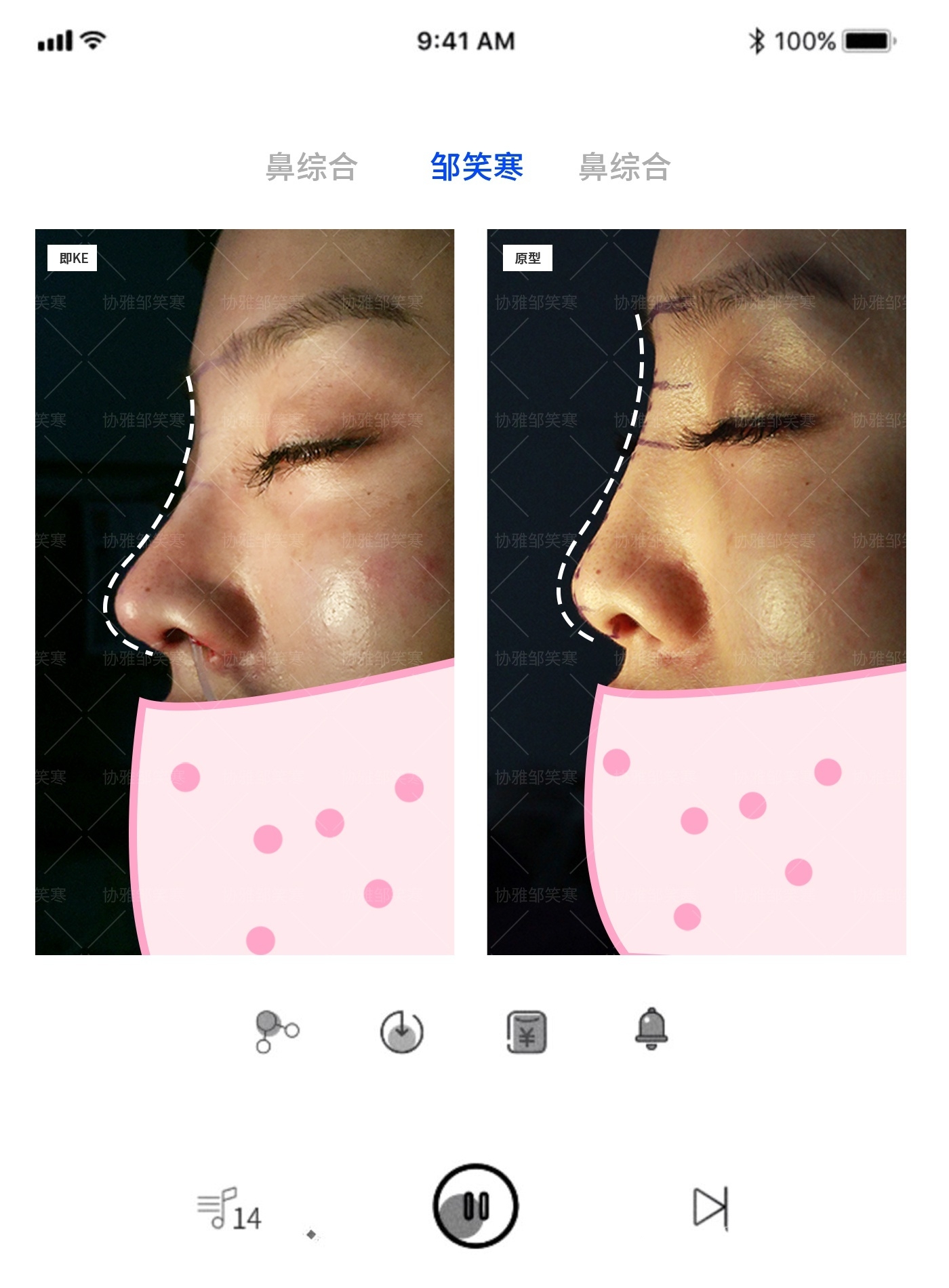 塌鼻梁女生一定不好看吗？_邹笑寒_副主任医师_爱问健康