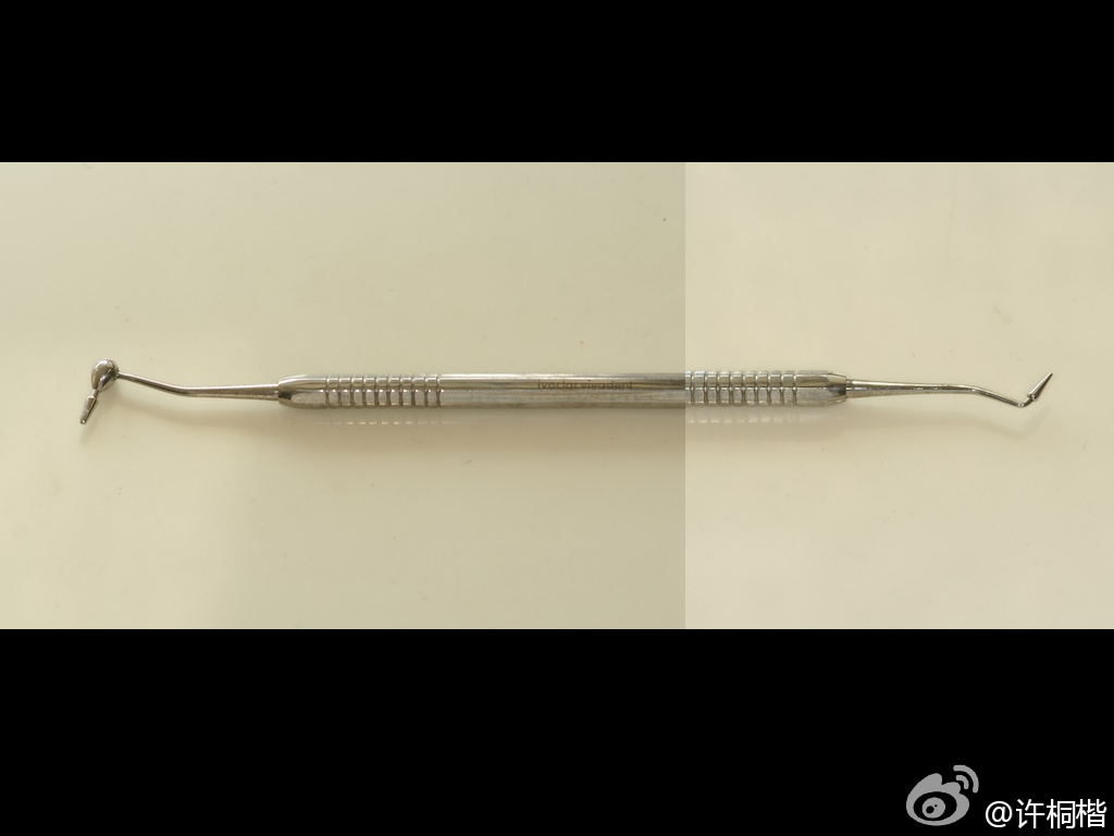 为什么牙医不用开口器初试Ivoclar大块充填（bulk fill）树脂_https://www.jmylbn.com_新闻资讯_第6张