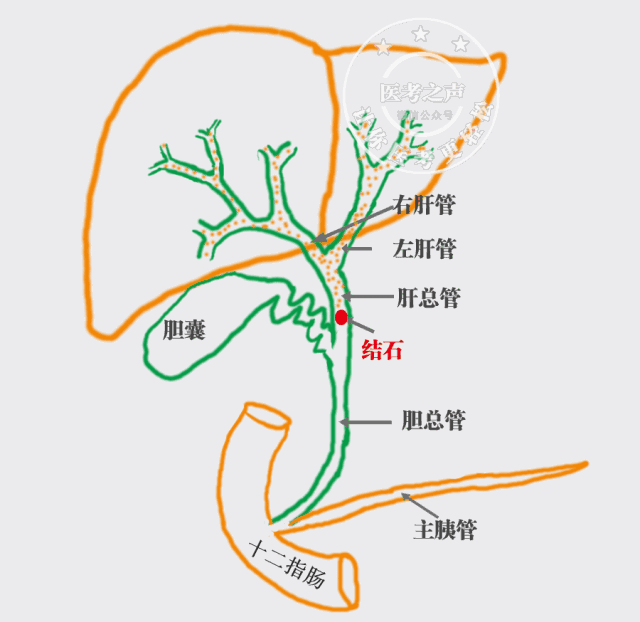 胆管位置图片