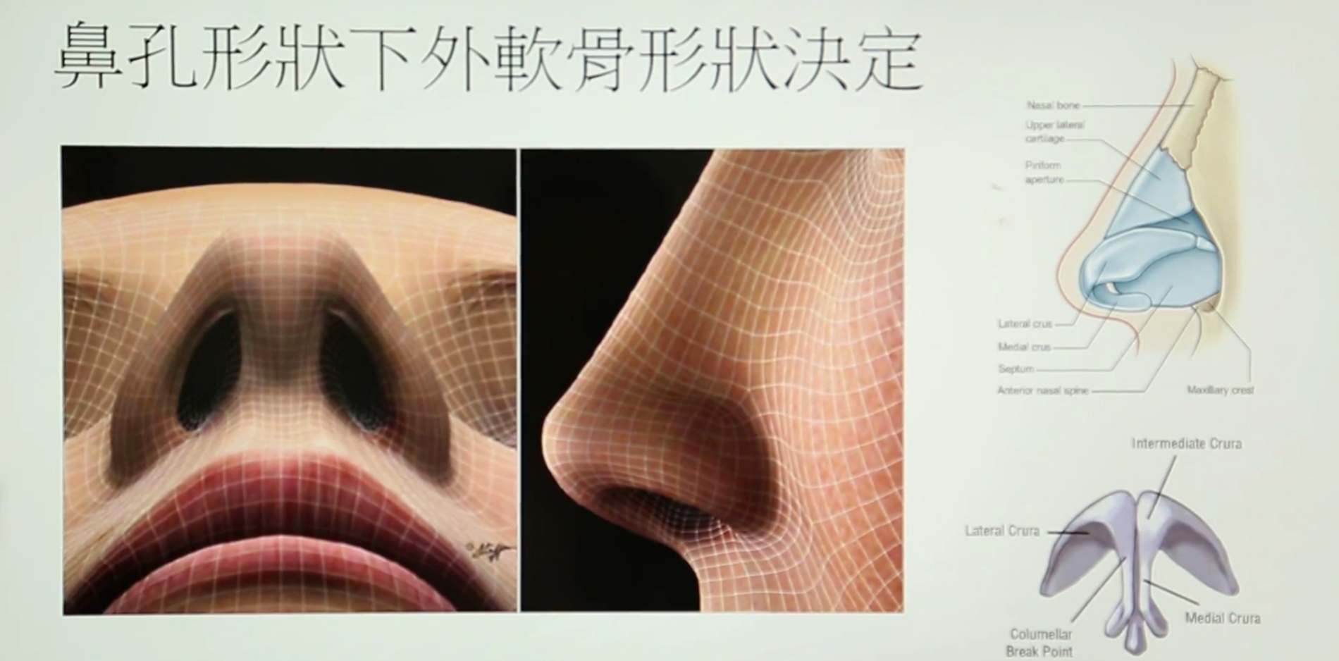如何做出自然的鼻型,水滴型鼻孔?_徐向民__爱问健康