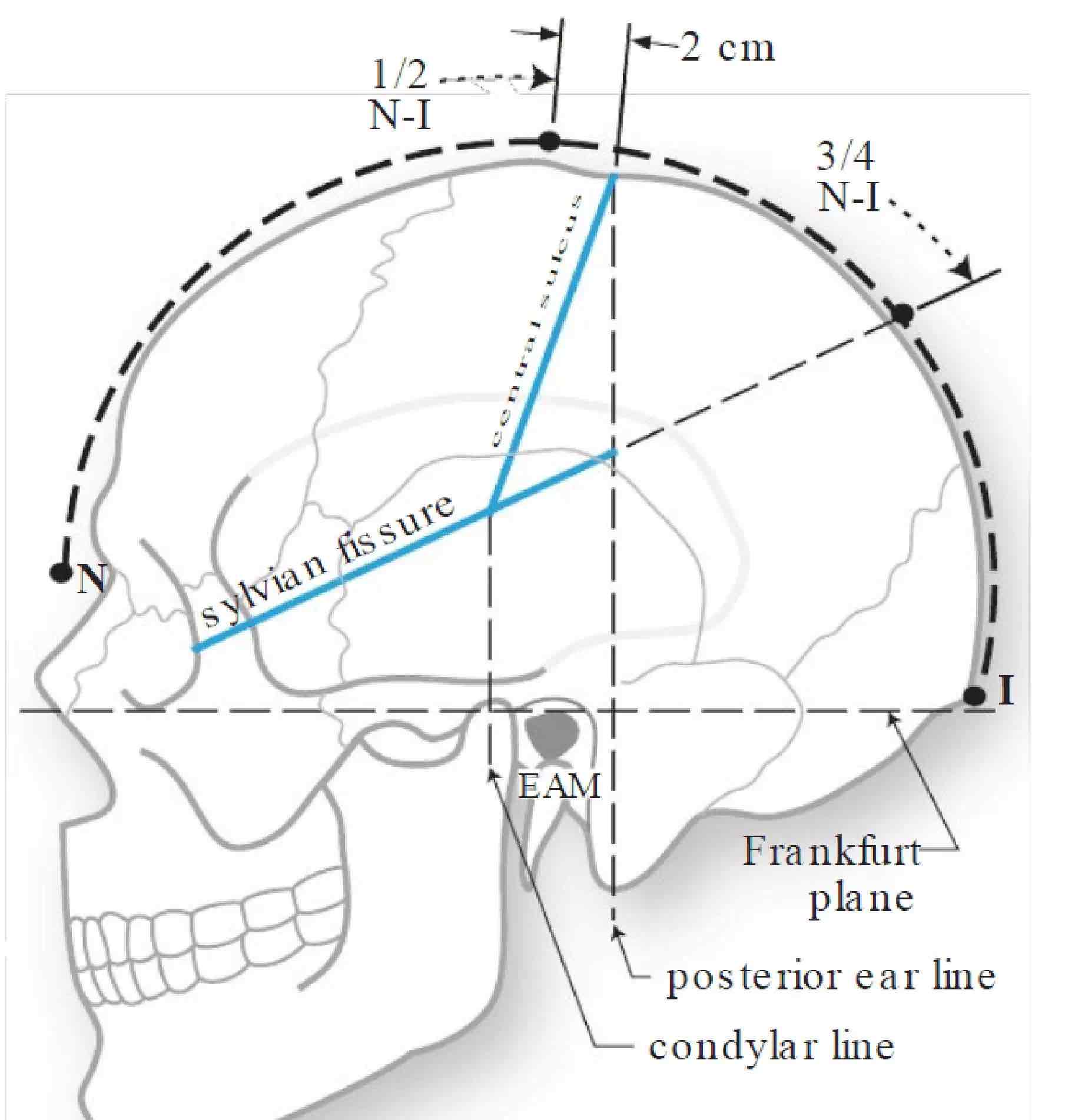 外侧裂和中央沟的定位