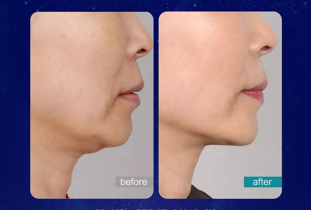 线雕线材那么多,为什么选择悦升线?