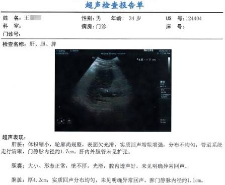 肝脏B超检查单应该怎么看_王光健__爱问健康
