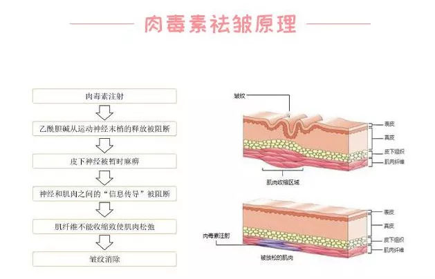 src=http___m.qiaomeite.cn_repository_image_p--saNCOQJqSpZ2UTXXbEA.jpg_k=1556607864000&refer=http___m.qiaomeite.jpg