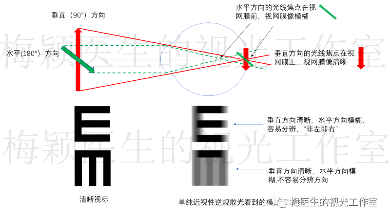 散光300度但视力0.8,看得清楚为什么要戴眼镜?