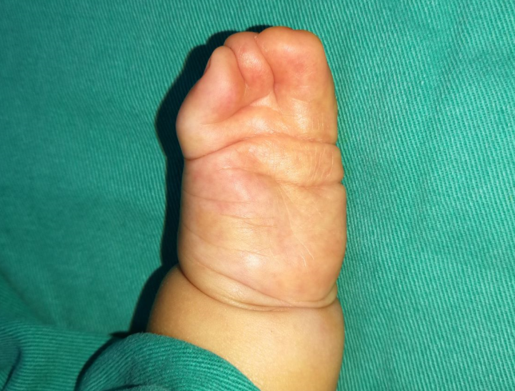 并指手术哪个医生最好?_陈江海_副主任医师_爱问健康