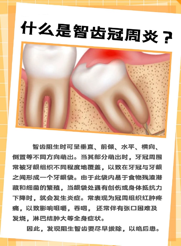 什么是智齿冠周炎？_郭慧彪__爱问健康