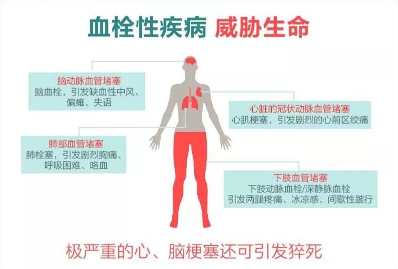 血栓,超过艾滋病,乳腺癌和前列腺癌,高速公路交通事故死亡人数之和