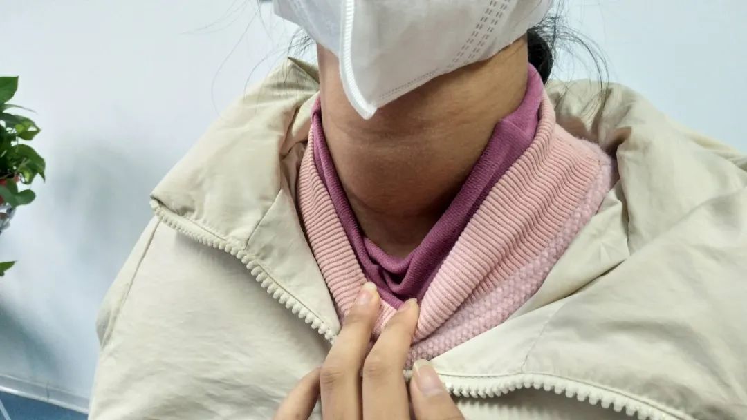 真实案例16岁花季少女患桥本甲减脖子肿起大包