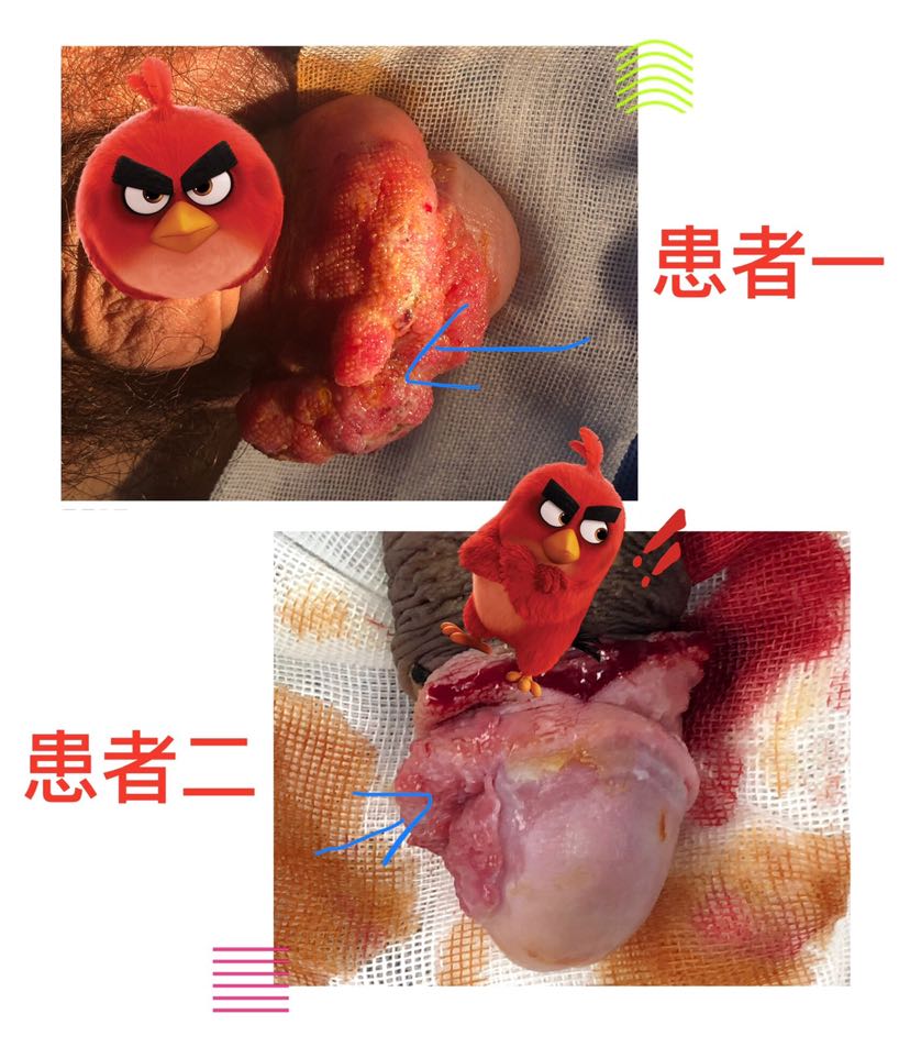 保护好小鸟系列三折翼的鸟儿