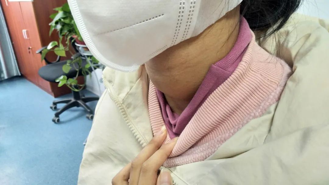 真实案例16岁花季少女患桥本甲减脖子肿起大包