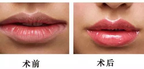 有了这个珠,性感一百分!_于燕_副主任医师_爱问健康