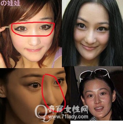 疑似张馨予小号曝出众多秘密 张馨予大方承认整容(多图)_新浪整形美容