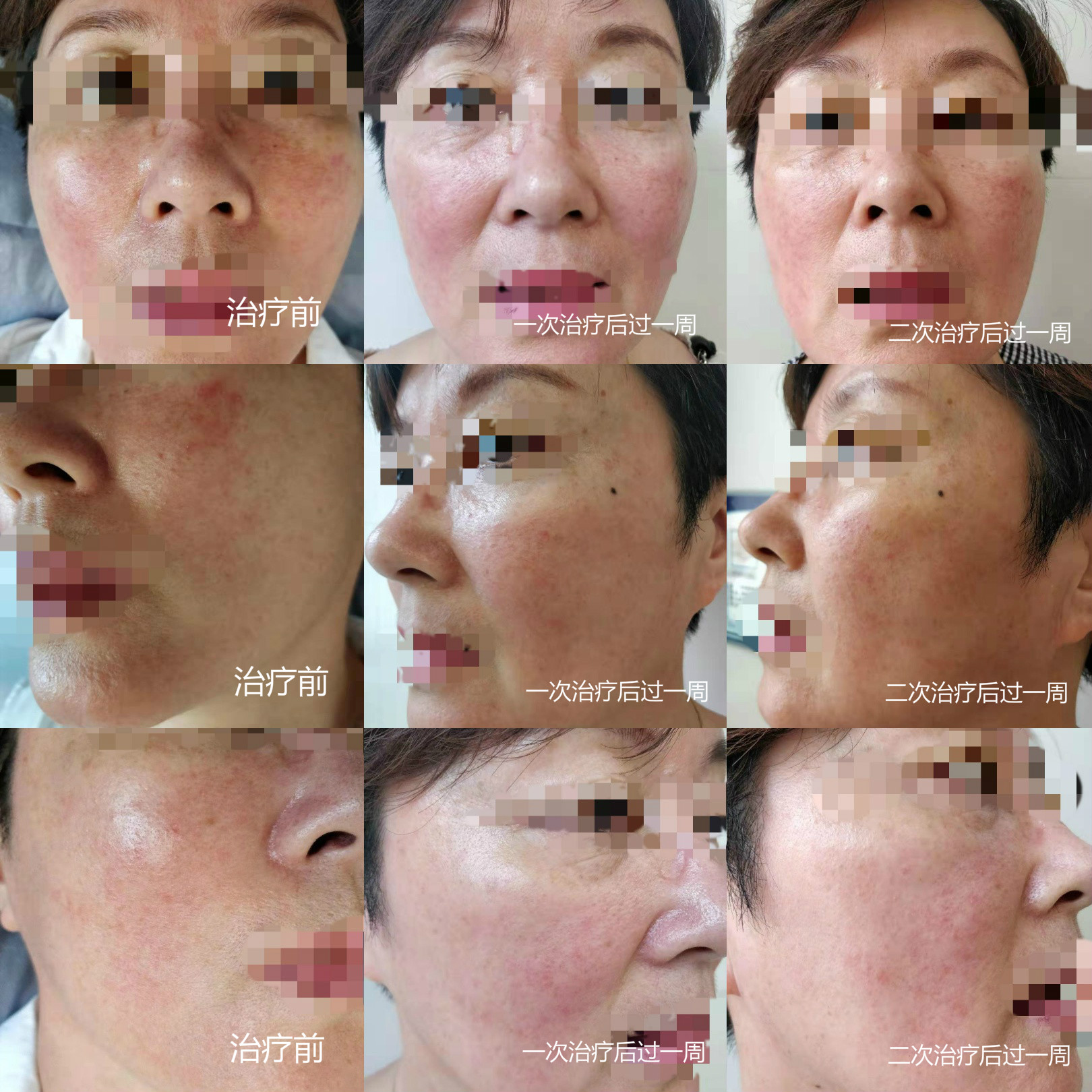 舒敏之星/敏感肌肤解决方案_朱敏刚_主任医师_爱问健康