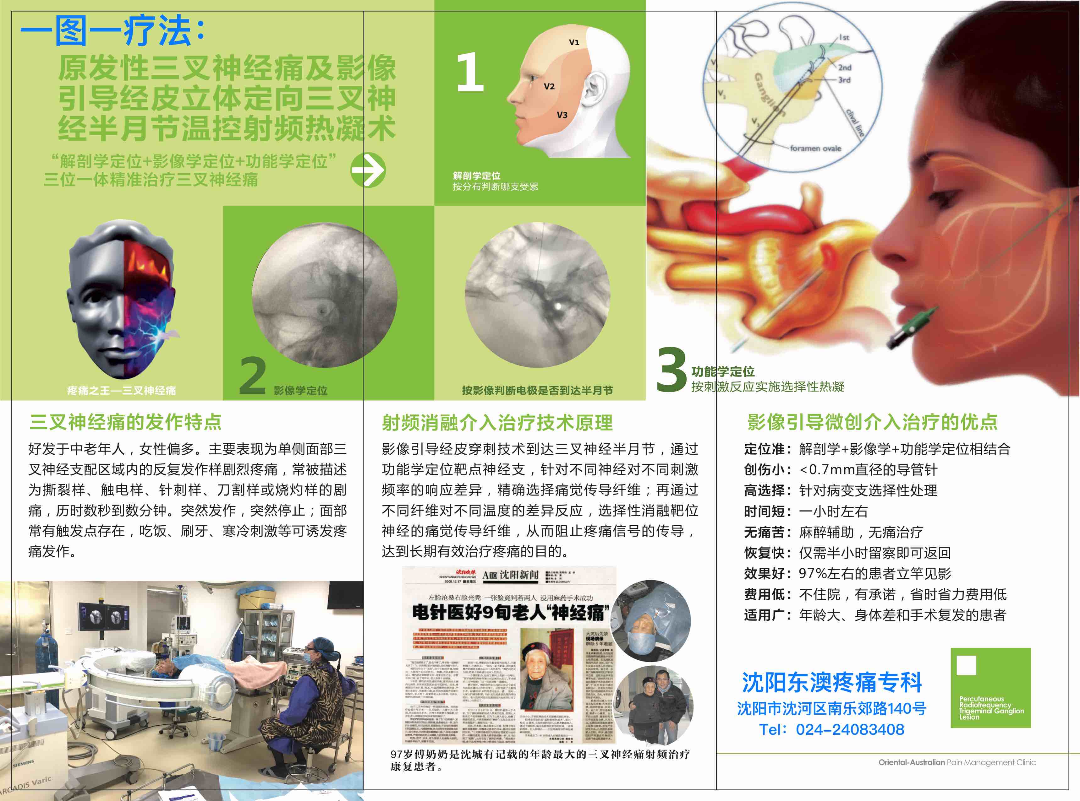 一图一疗法:“三叉神经半月节温控射频热凝术”治疗三叉神经痛_倪忠阁_副主任医师_爱问健康