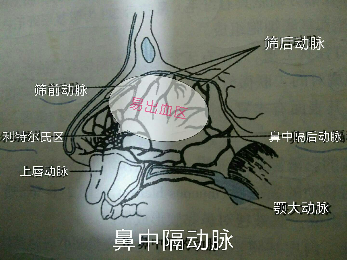 频繁的鼻出血怎么办啊?_高宏飞_副主任医师_爱问健康