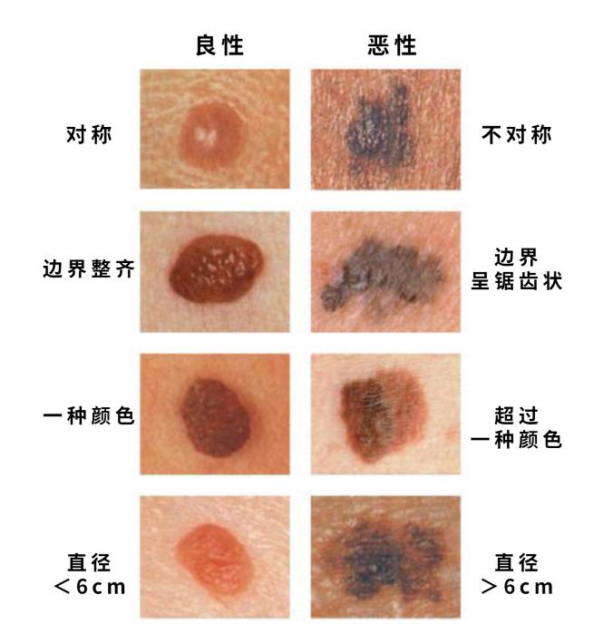 肌肤与健康之间不得不说的秘密