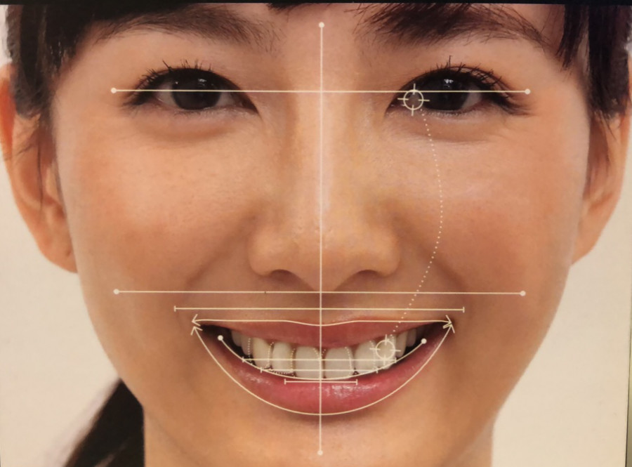为什么我笑起来不好看？_徐娜_主治医师_爱问健康