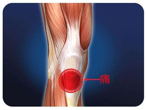 腿不直还膝盖痛?膝关节第一杀手【Q角】了解一下_陈博闻__爱问健康