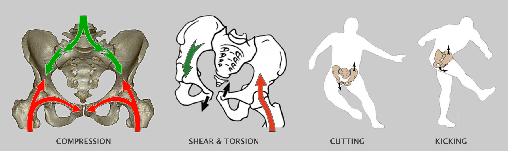体态讲解系列(2)---骨盆对人体的影响