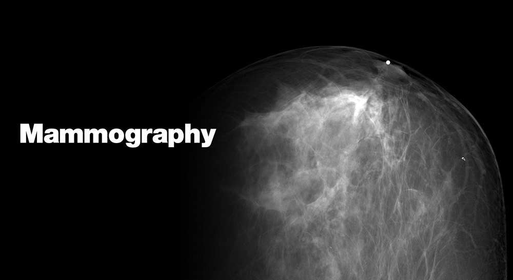 mammography (1).jpg