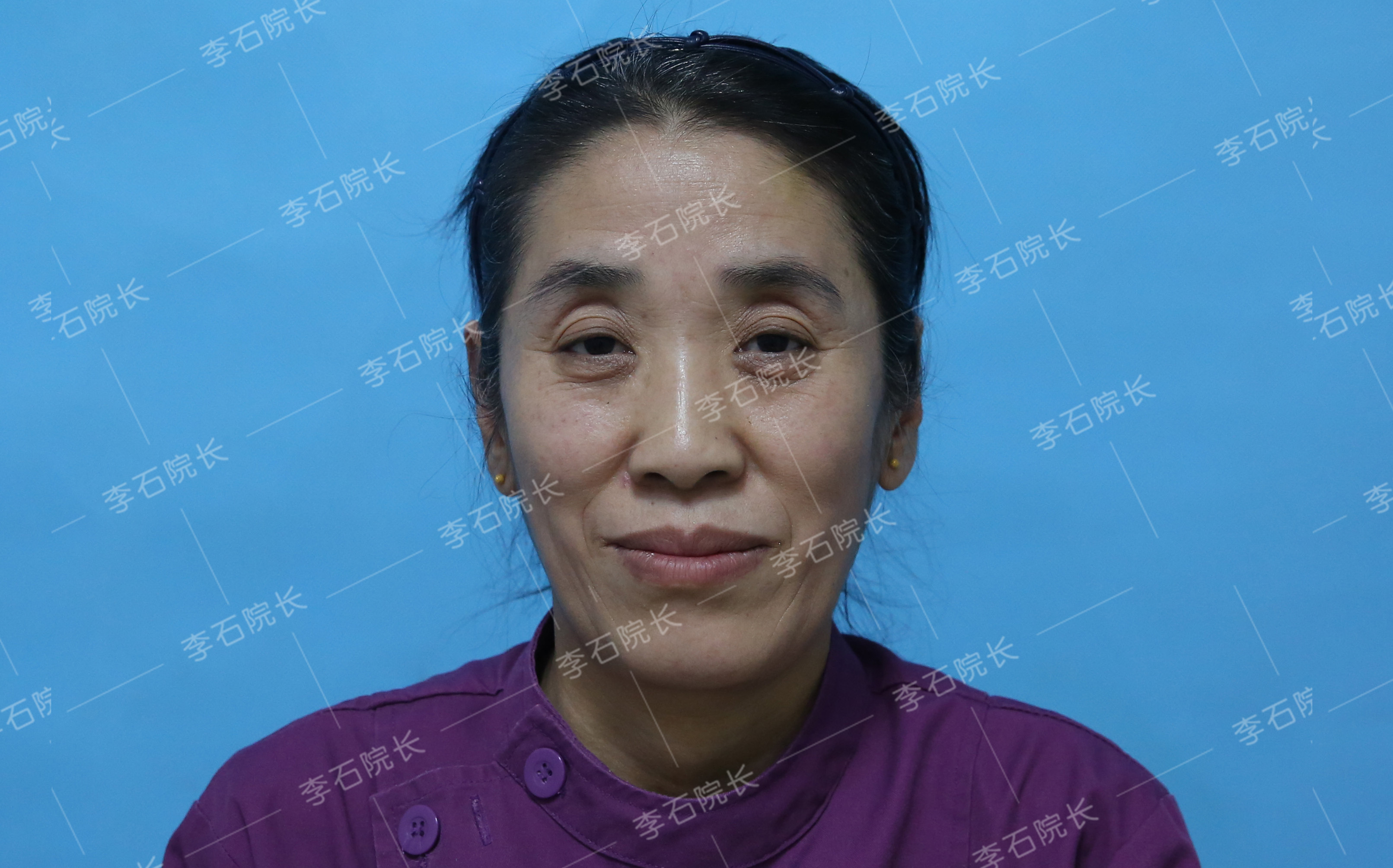 李石_主治医师_爱问健康