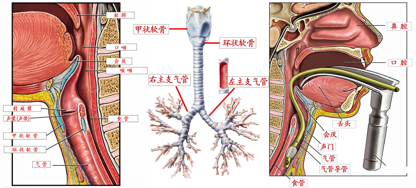 碰到气管异物阻塞