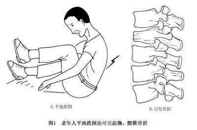 胸椎骨折后卧床姿势图图片